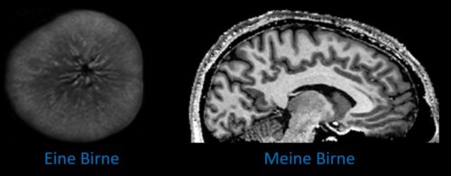 Magnetresonanztomografie-Aufnahme: links eine Birne, rechts ein Gehirn "meine Birne"