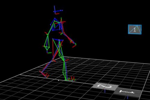 Bewegungsanalyse im Ganglabor. Die Körperteile sind in verschiedenfarbigen Strichen dargestellt.
